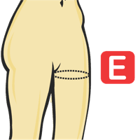 Circunferencia del muslo 